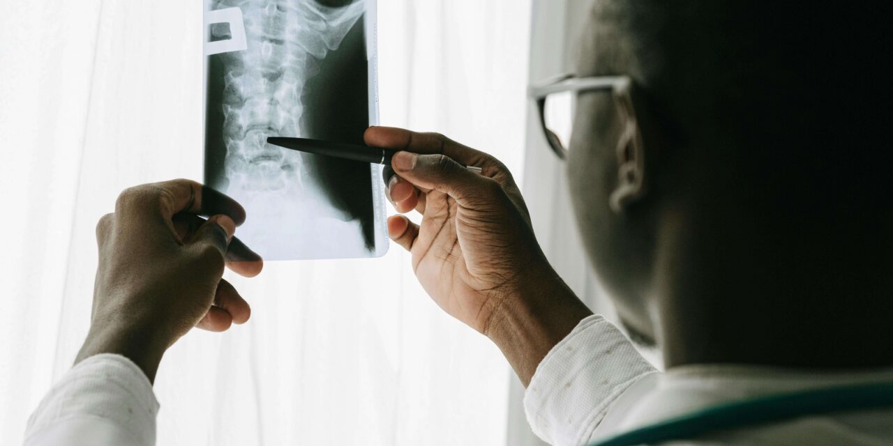 Degenerative Disc Disease and SSI: How to Qualify in Los Angeles