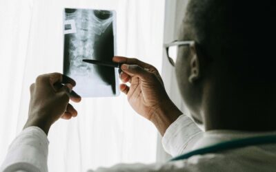 Degenerative Disc Disease and SSI: How to Qualify in Los Angeles