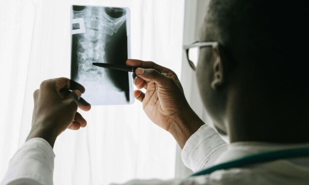 Degenerative Disc Disease and SSI: How to Qualify in Los Angeles